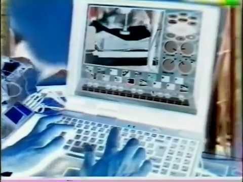 More Beats + Pieces