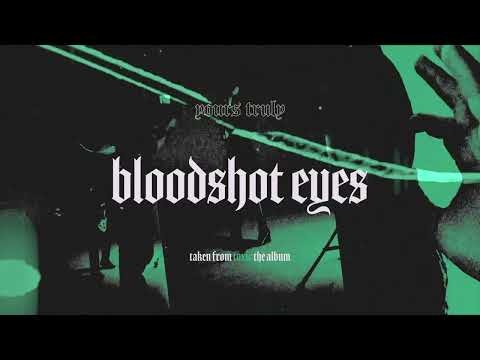 Bloodshot Eyes
